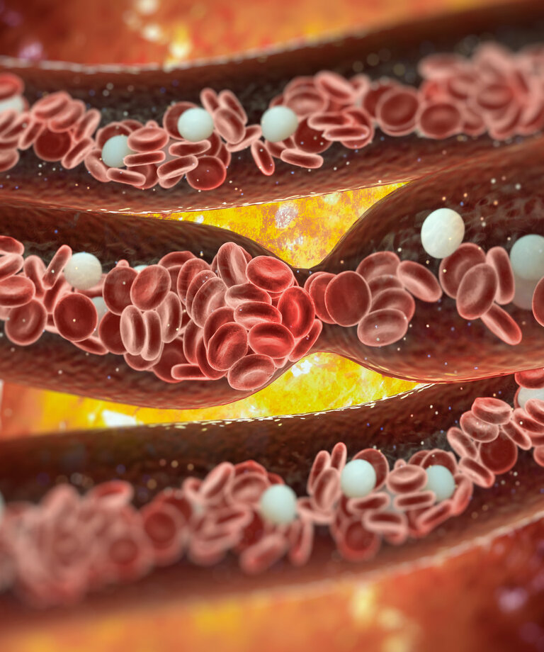 NO oxid dusnatý a cévy