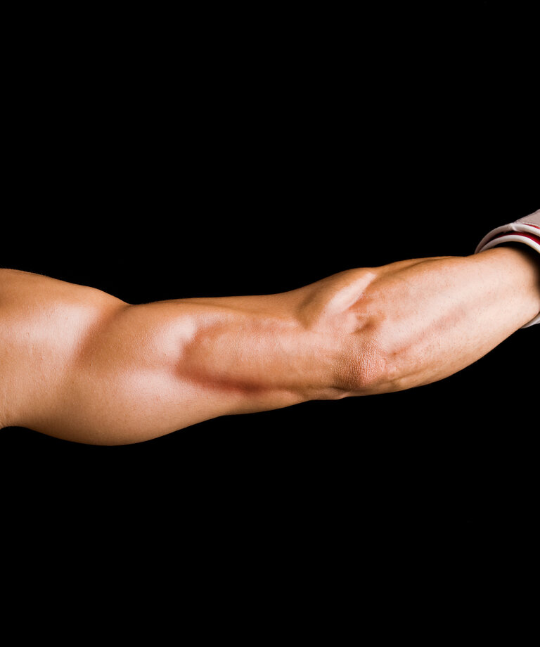 Aminokyseliny L-citrulín-malát