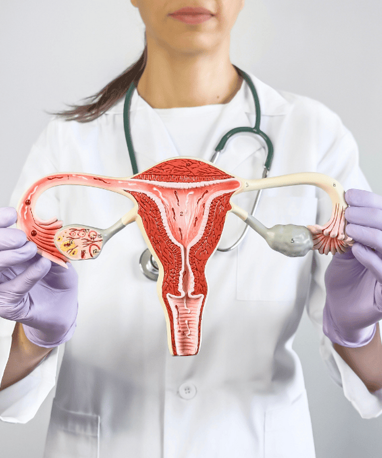 Co je PCOS a jaká je léčba polycystických ovárií?